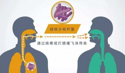 共享健康 终结结核 | 德州市第二人民医院专家权威解读结核病防治
