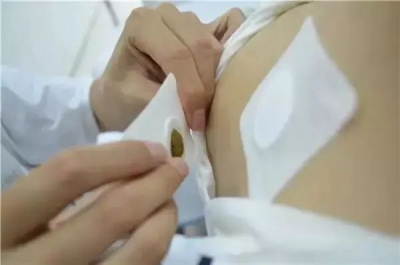 8月15日“末伏”开贴！点击查看“三伏贴”贴敷最全攻略→