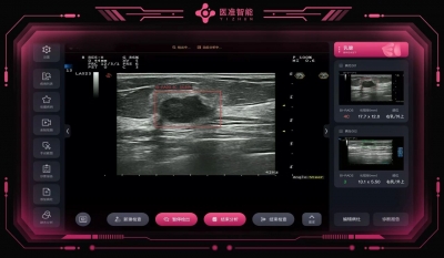 齐鲁医院德州医院开启智能诊疗新时代