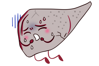 “人体都江堰”工程-TIPS手术——肝硬化门脉高压出血的最后一道防线